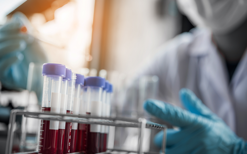 a row of pipettes in a stand with a gloved hand out of focus behind them.